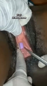 Dildo break and stuck in feminist pussy